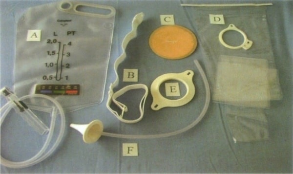 Colostomy Irrigation: A Method Of Bowel Management | Omnigon